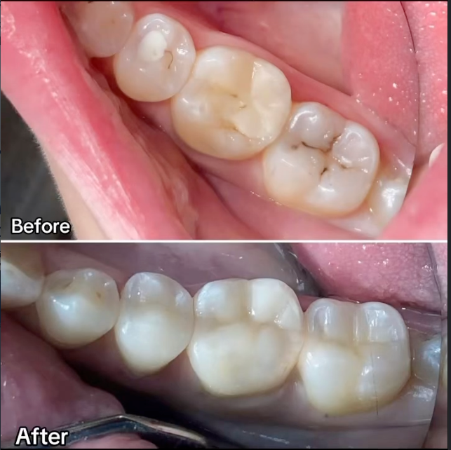 Effective Filling Solutions