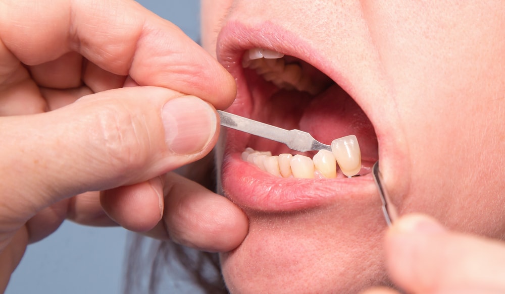 Auburn Dental Magic - Dentist
