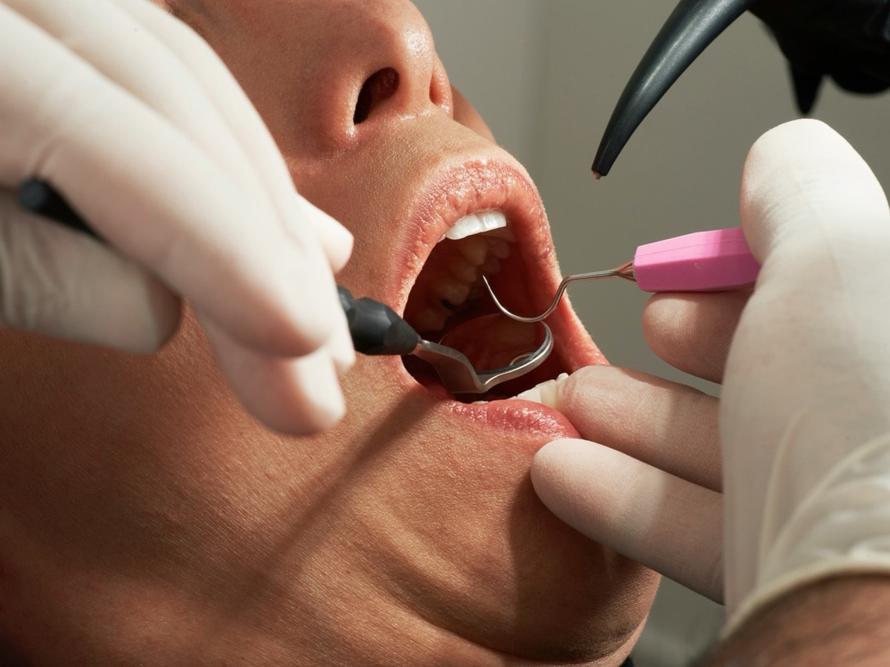Dental Check-Ups & Cleans